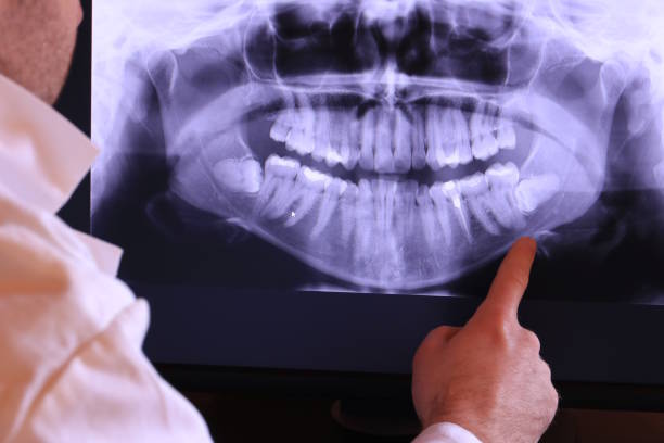 Best Emergency Treatment for Jaw Pain or Injury in Morada, CA